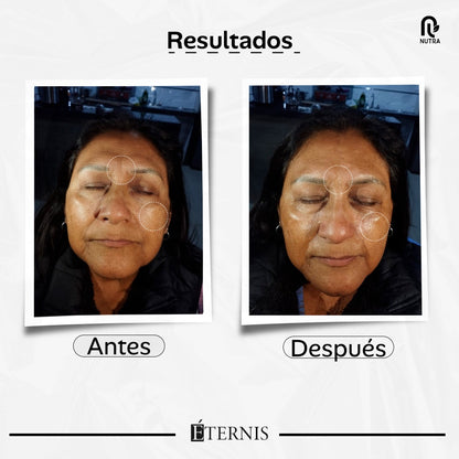 ÉTERNIS SERUM X 30 ML EFECTO TENSOR INMEDIATO